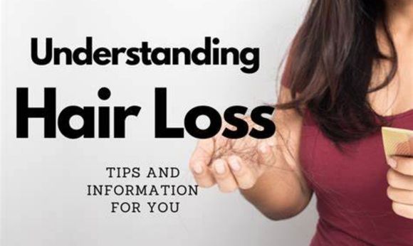 100 Hair Loss Tips