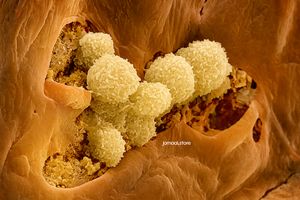 3D Colored SEM of Human Papillomavirus Cells – High-Resolution Scientific Image
