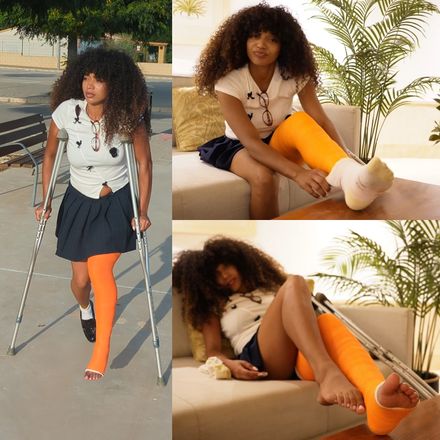 Broken fibula: LLC· pain · socks 2/2 by Jade