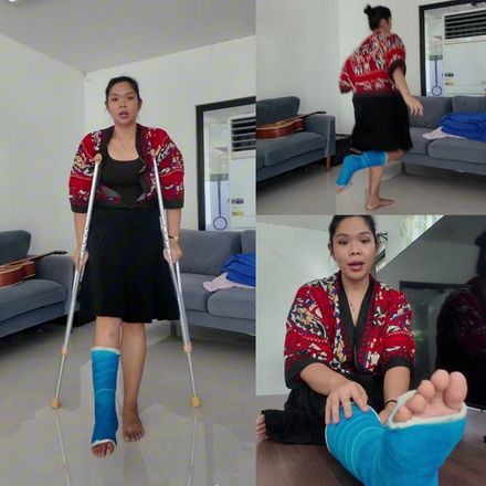 Real injury SLC · indoor crutching · talking · hopping by Hiraya