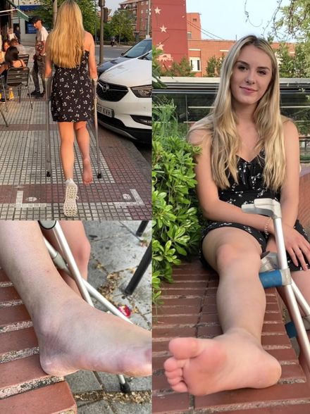 Real injury barefoot sprained ankle street crutching by Elissa