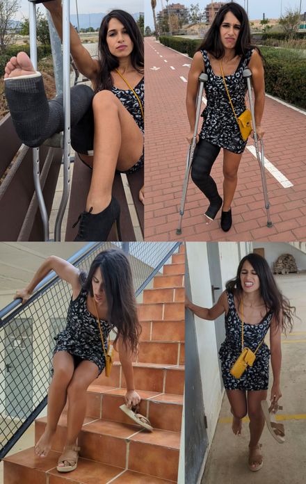 broken leg LLC accident, pain, crutching, and high heel by Sabina