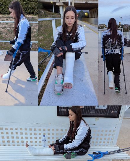 Real injury SLC · long public street crutching · bruise &amp; swollen · toering 5/9 by Adri