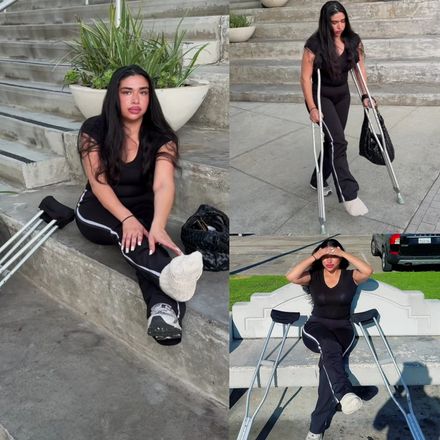 Real injury SLC · thick sock &amp; street crutching by Daniela