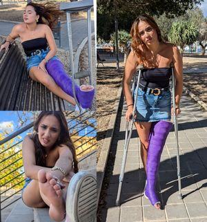 Broken leg accident: Barefoot then LLC by Ela