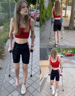 Real injury cast off · barefoot street crutching by Gema