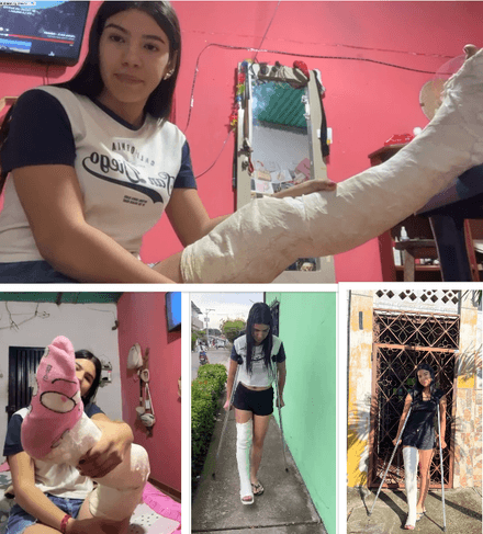 Real injury LLC · old cast · crutching · close-ups by Melinda