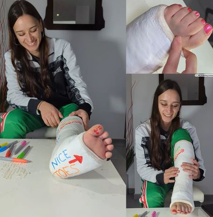 Real injury SLC · cast drawing and interview 7/9 by Adri