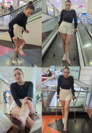 Sprained ankle swollen toes and mall crutching by Ela 