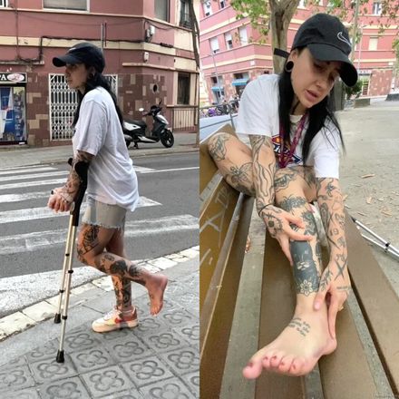 Real injury barefoot street crutching by Mindarina