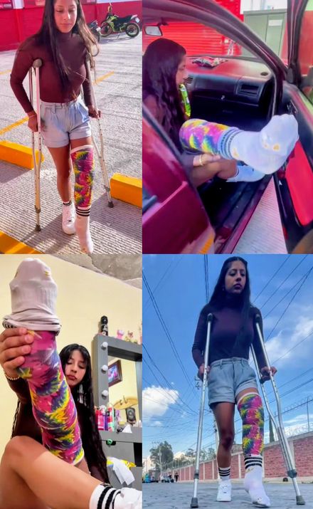 Real injury LLC sock crutching and putting on socks by Mejo