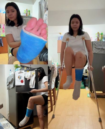 Real injury SLC · hopping &amp; limping · home routine by Hiraya