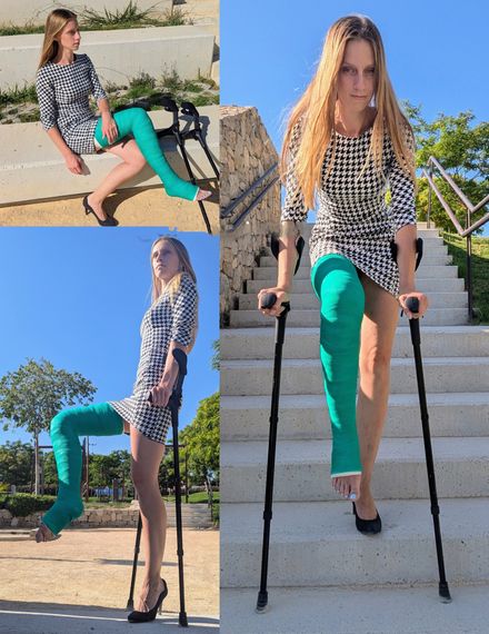 Broken Leg, Strong Will: Kim’s Story Begins 1/3 by Kim