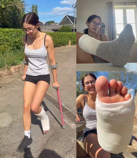 Real injury SLC · outside crutching · resting · socks by Adele