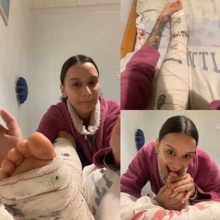 Real injury med SLC broken fibula 1/9 by Adri