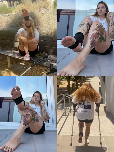 Real injury sprained ankle stairs · street crutching · close-ups talking by Valentina 