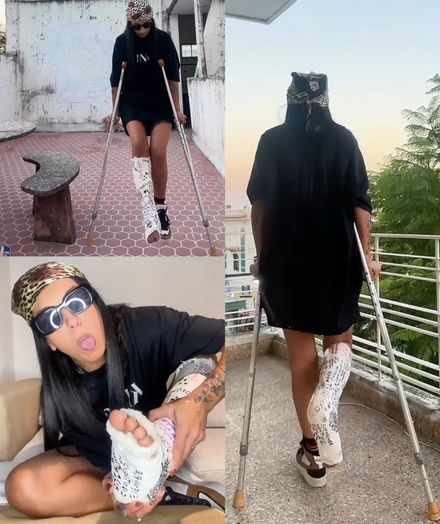 Real injury SLC indoor crutching &amp; close-ups by Catalina 