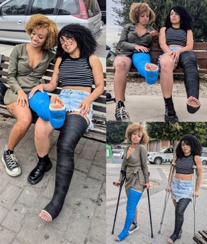 Dual LLC: Random street encounter, foot massage and crutching by Cami and Charlotte