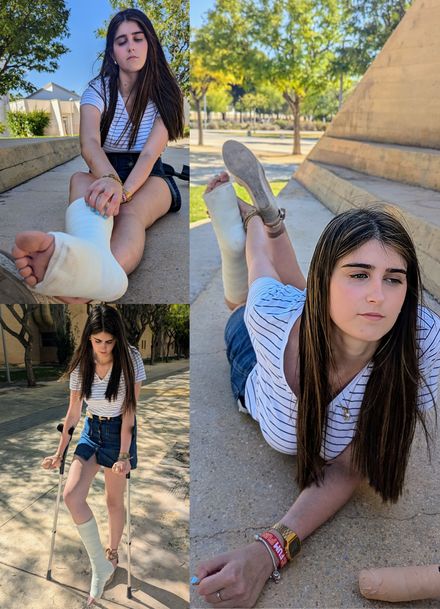 Broken ankle: PART 2/2 by Mia