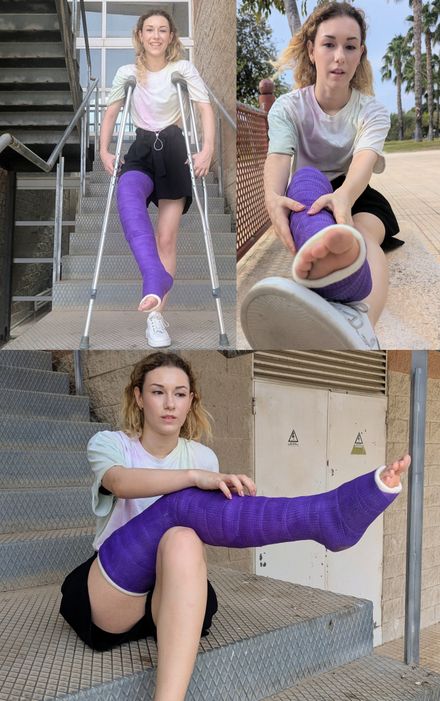 College days: LLC stairs falls and long crutching 1/3 by Pame 