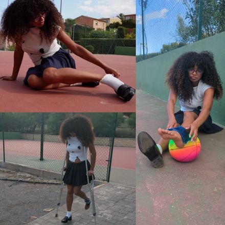 Broken fibula: Accident · pain · hopping 1/2 by Jade