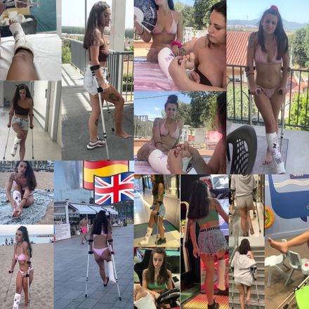 Real injury Med SLC Copilation 2 months time lapse 