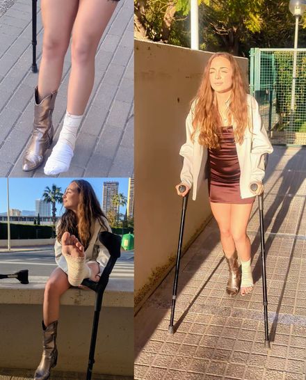 Sprained ankle toes off-sock public crutching by Paula