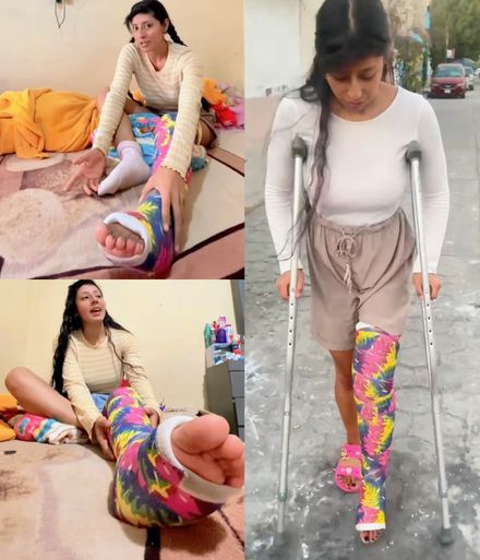 Real injury LLC street crutching and bed talking 