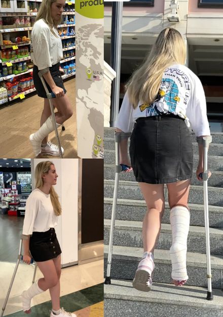 Real injury sprained ankle mall crutching by Elissa 