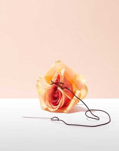 ولادة بدون غرز 🪡