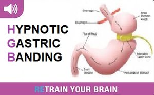 Hypnotic Gastric Banding