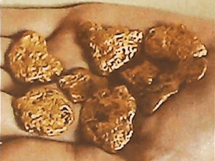 Real Treasure Recovery