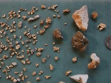 The Christmas Nugget