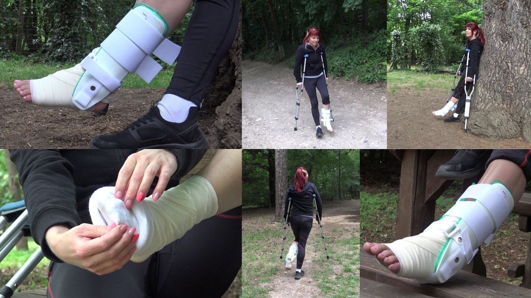 Norina - Sprained during the run Part2