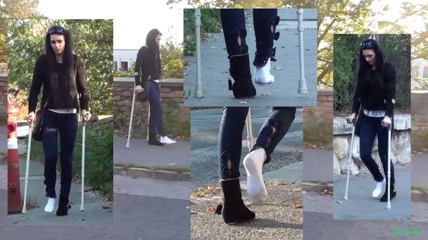 Jessica - Dislocated Ankle Part2