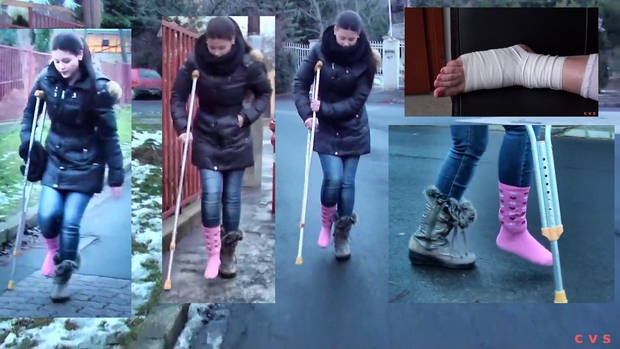 Sprain for Christmas Part 1