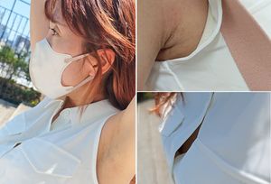 ノースリ白ワンピ女子の伸びかけ腋毛を追跡超接写