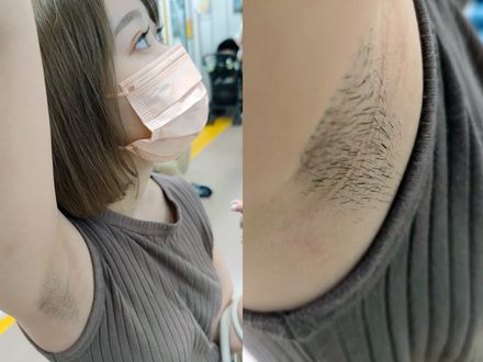 美人OLの恥ずかし過ぎる濃密ジョリ腋を長尺超接写 Super close-up of beautiful lady&#x27;s embarrassingly dense armpit hair!