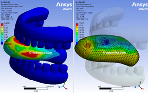 ANSYS  Workbench 2022 R1 solved WBPZ file and 3 D model for tongue biting