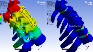 ANSYS Workbench 2023 R1 solved WBPZ file and 3D model for Cervical Discectomy and Fusion