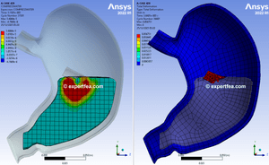 ANSYS Workbench 2022 R1 WBPZ archive and 3D model for bolus entering stomach