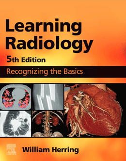  Learning Radiology: Recognizing the Basics 5th Edition