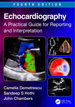 Echocardiography: A Practical Guide for Reporting and Interpretation, 4th Edition