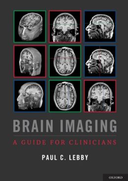 Brain Imaging: A Guide for Clinicians