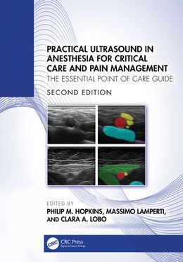 Practical Ultrasound in Anesthesia for Critical Care and Pain Management