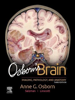 Osborn's Brain: Imaging, Pathology and Anatomy 3rd Edition