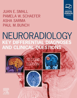  Neuroradiology: Key Differential Diagnoses and Clinical Questions 2nd Edition 
