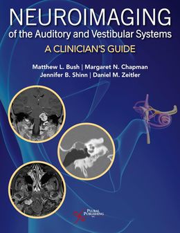 Neuroimaging of the Auditory and Vestibular Systems: A Clinician’s Guide