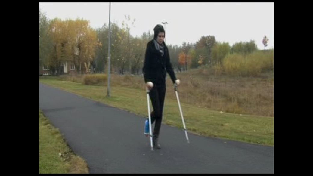 Sandish 7 SLC - I just come from the hospital and my leg hurt and my cast starts itch - 9 min