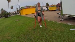 Nathalia 2210-4 Mallorca Sprain - I show my sprained and bandage ankle for you - 10 min